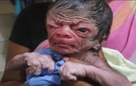 Un «vieux bébé» est né au Bangladesh