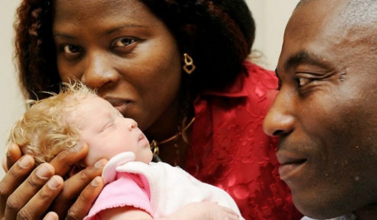 INCROYABLE: ces couples africains qui ont donné naissance à un bébé blanc [photos]