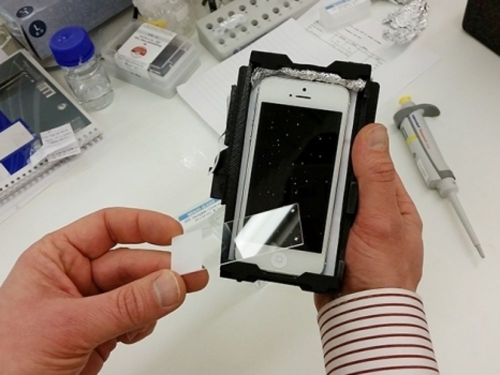 Cancer : des chercheurs inventent la détection de tumeurs avec un smartphone