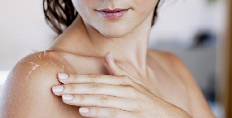 Maroc / Maladie chronique de la peau : 750.000 Marocains touchés par le psoriasis